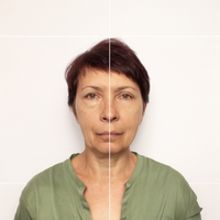 Collagen Scar Tape™