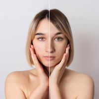 Collagen Scar Tape™