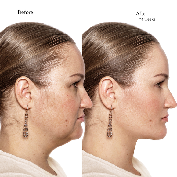 Feature product image