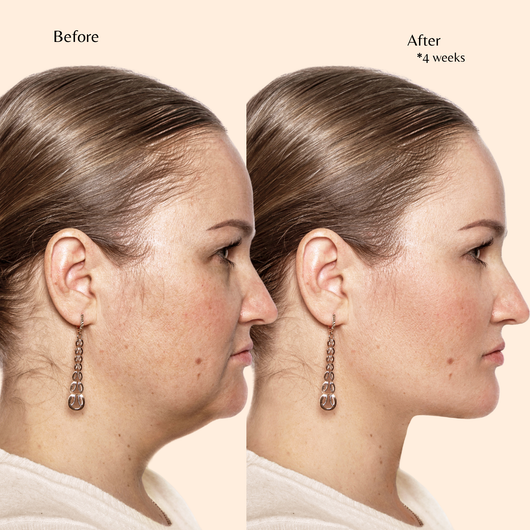 D-Puff™ – Facial Detox & Massage Brush